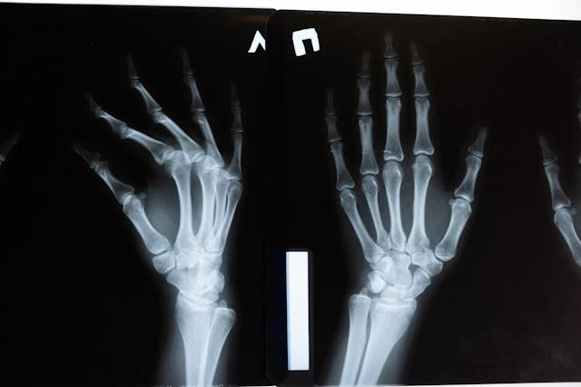 Stratford-upon-Avon catastrophic injury
