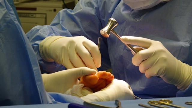 Wirksworth GP negligence